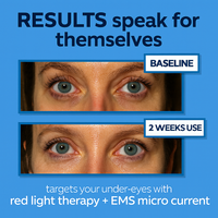 Reviio™ EyeLift